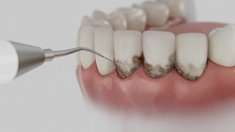 Reliable Tooth Extraction contractor in Fairfax city County, VA by Dentist Open Now